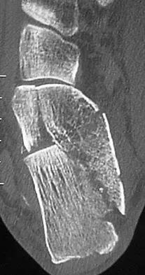 General Orthopedics Board Review 2026: High-Yield MCQs (Set 16) - Figure 47