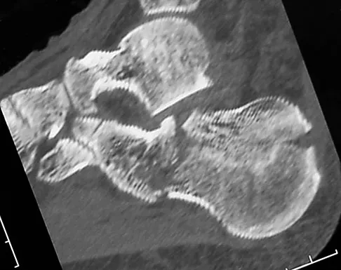 General Orthopedics Board Review 2026: High-Yield MCQs (Set 16) - Figure 48