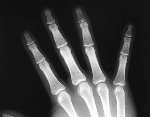 General Orthopedics Board Review 2026: High-Yield MCQs (Set 16) - Figure 53