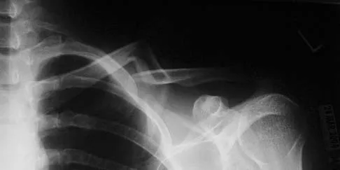 General Orthopedics Board Review 2026: High-Yield MCQs (Set 16) - Figure 55