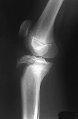 General Orthopedics Board Review 2026: High-Yield MCQs (Set 16) - Figure 6