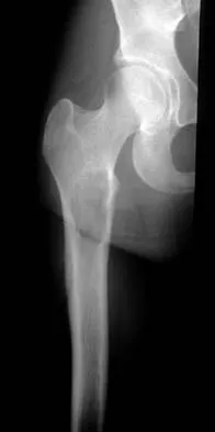 General Orthopedics Board Review 2026: High-Yield MCQs (Set 16) - Figure 60