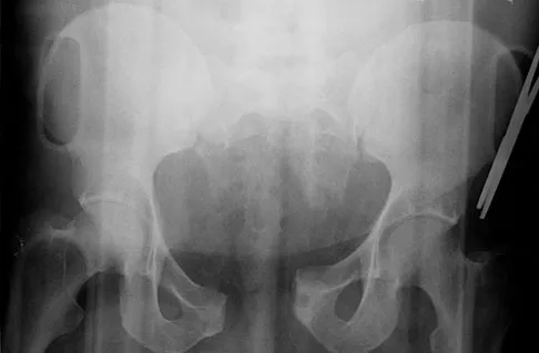 General Orthopedics Board Review 2026: High-Yield MCQs (Set 16) - Figure 62