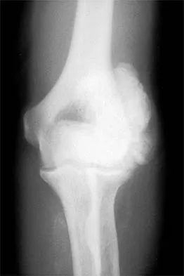 General Orthopedics Board Review 2026: High-Yield MCQs (Set 16) - Figure 66