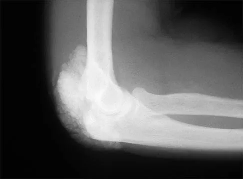 General Orthopedics Board Review 2026: High-Yield MCQs (Set 16) - Figure 67
