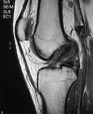 General Orthopedics Board Review 2026: High-Yield MCQs (Set 16) - Figure 70