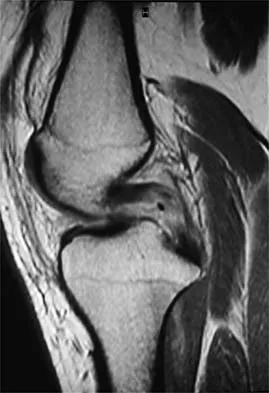 General Orthopedics Board Review 2026: High-Yield MCQs (Set 16) - Figure 71