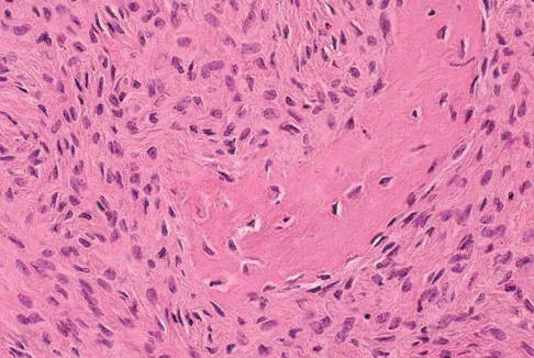 General Orthopedics Board Review 2026: High-Yield MCQs (Set 16) - Figure 78
