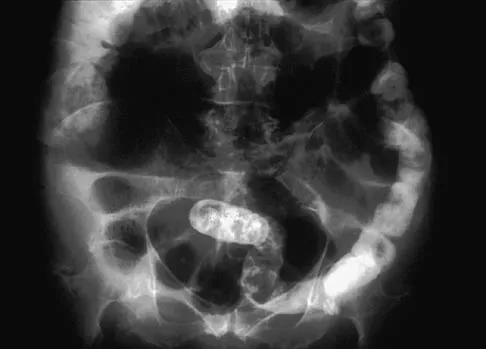 General Orthopedics Board Review 2026: High-Yield MCQs (Set 16) - Figure 79