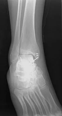 General Orthopedics Board Review 2026: High-Yield MCQs (Set 16) - Figure 8