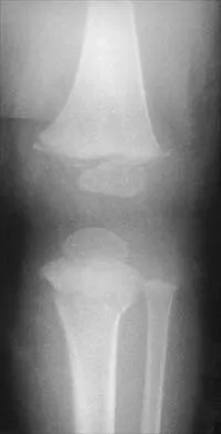 General Orthopedics Board Review 2026: High-Yield MCQs (Set 16) - Figure 81