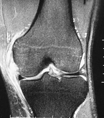 General Orthopedics Board Review 2026: High-Yield MCQs (Set 16) - Figure 85