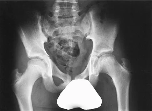 General Orthopedics Board Review 2026: High-Yield MCQs (Set 16) - Figure 88