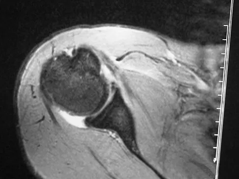 General Orthopedics Board Review 2026: High-Yield MCQs (Set 16) - Figure 94