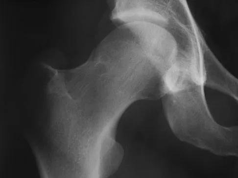 General Orthopedics Board Review 2026: High-Yield MCQs (Set 16) - Figure 95