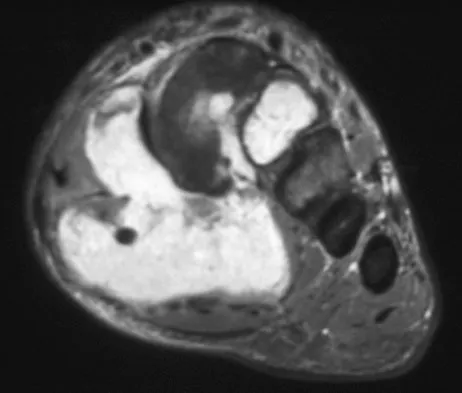 General Orthopedics 2026 Practice Questions: Set 17 (Solved) - Figure 10
