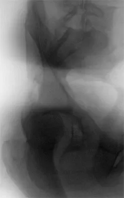 General Orthopedics 2026 Practice Questions: Set 17 (Solved) - Figure 14