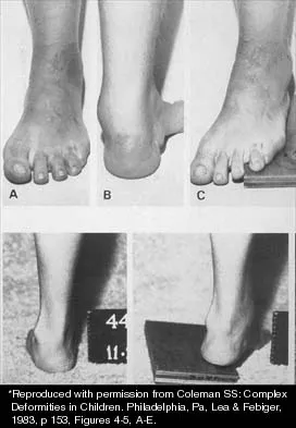 General Orthopedics 2026 Practice Questions: Set 17 (Solved) - Figure 16