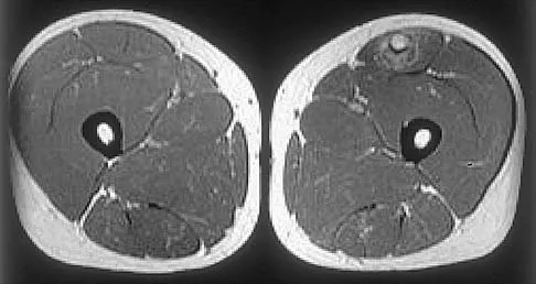 General Orthopedics 2026 Practice Questions: Set 17 (Solved) - Figure 18