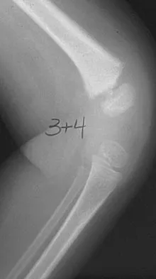 General Orthopedics 2026 Practice Questions: Set 17 (Solved) - Figure 24