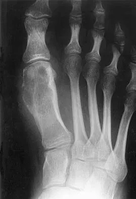 General Orthopedics 2026 Practice Questions: Set 17 (Solved) - Figure 26