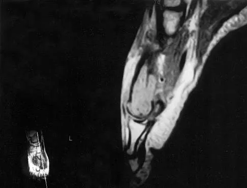 General Orthopedics 2026 Practice Questions: Set 17 (Solved) - Figure 27