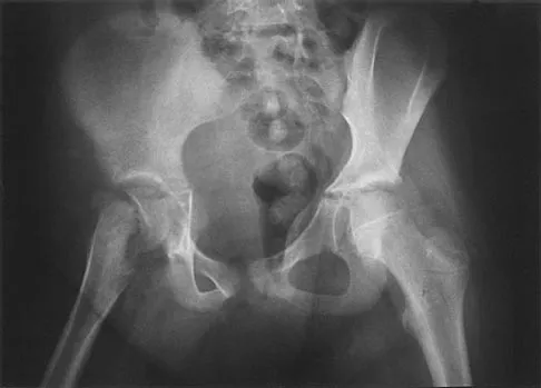 General Orthopedics 2026 Practice Questions: Set 17 (Solved) - Figure 29