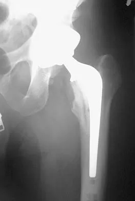 General Orthopedics 2026 Practice Questions: Set 17 (Solved) - Figure 30