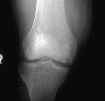 General Orthopedics 2026 Practice Questions: Set 17 (Solved) - Figure 32