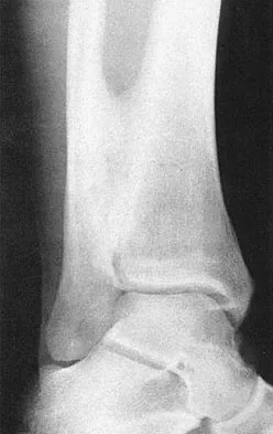 General Orthopedics 2026 Practice Questions: Set 17 (Solved) - Figure 35