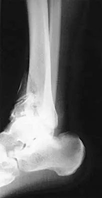 General Orthopedics 2026 Practice Questions: Set 17 (Solved) - Figure 38