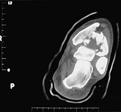 General Orthopedics 2026 Practice Questions: Set 17 (Solved) - Figure 39