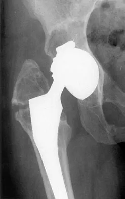 General Orthopedics 2026 Practice Questions: Set 17 (Solved) - Figure 4