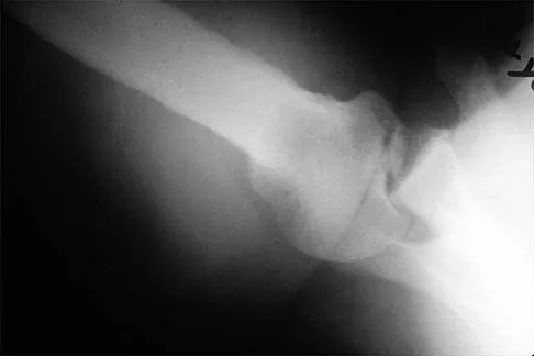 General Orthopedics 2026 Practice Questions: Set 17 (Solved) - Figure 48