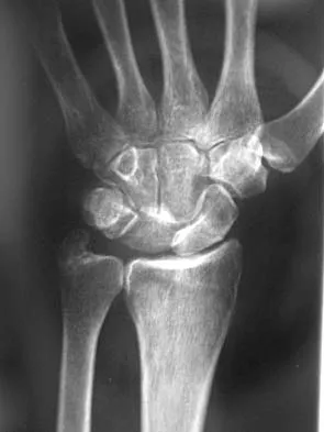 General Orthopedics 2026 Practice Questions: Set 17 (Solved) - Figure 52