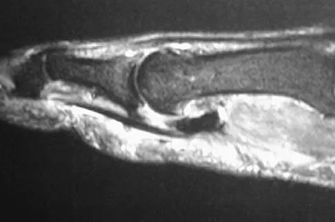General Orthopedics 2026 Practice Questions: Set 17 (Solved) - Figure 61