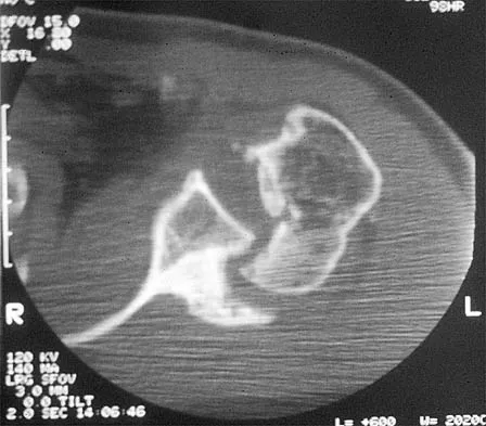 General Orthopedics 2026 Practice Questions: Set 17 (Solved) - Figure 64