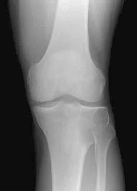 General Orthopedics 2026 Practice Questions: Set 17 (Solved) - Figure 69