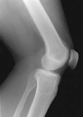 General Orthopedics 2026 Practice Questions: Set 17 (Solved) - Figure 70