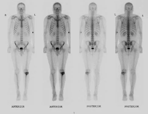 General Orthopedics 2026 Practice Questions: Set 17 (Solved) - Figure 71