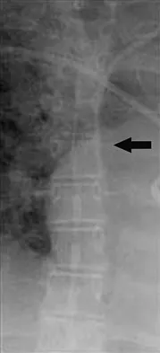 General Orthopedics 2026 Practice Questions: Set 17 (Solved) - Figure 74