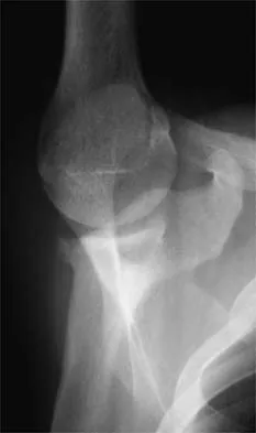 General Orthopedics 2026 Practice Questions: Set 17 (Solved) - Figure 8