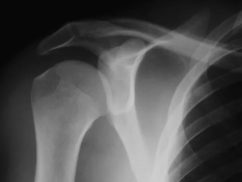 General Orthopedics 2026 Practice Questions: Set 17 (Solved) - Figure 81