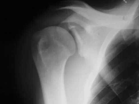 General Orthopedics 2026 Practice Questions: Set 17 (Solved) - Figure 82