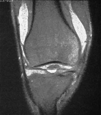 General Orthopedics 2026 Practice Questions: Set 17 (Solved) - Figure 84