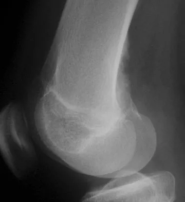 General Orthopedics 2026 Practice Questions: Set 17 (Solved) - Figure 87