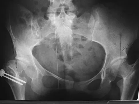 General Orthopedics 2026 Practice Questions: Set 17 (Solved) - Figure 88