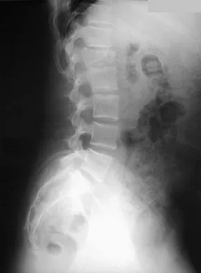 General Orthopedics 2026 Practice Questions: Set 17 (Solved) - Figure 89