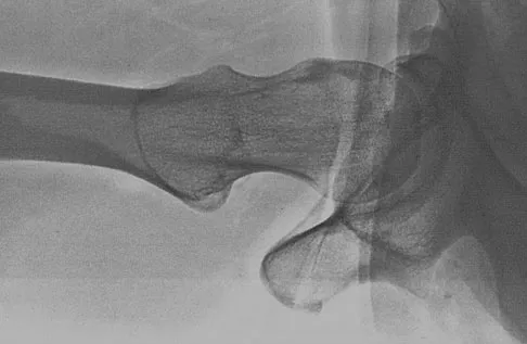 General Orthopedics 2026 Practice Questions: Set 17 (Solved) - Figure 93