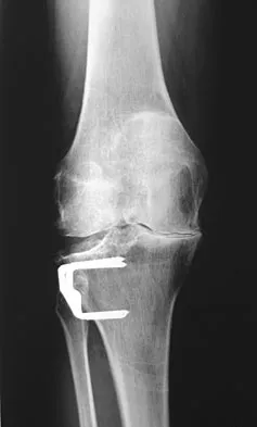 General Orthopedics Board Review 2026: High-Yield MCQs (Set 18) - Figure 1